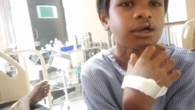 15 साल तक कटे होंठ-तालु से जूझता रहा बच्चा: ‘चिरायु’ दल ने कराया मुफ्त ऑपरेशन, चेहरे पर लौटी मुस्कान