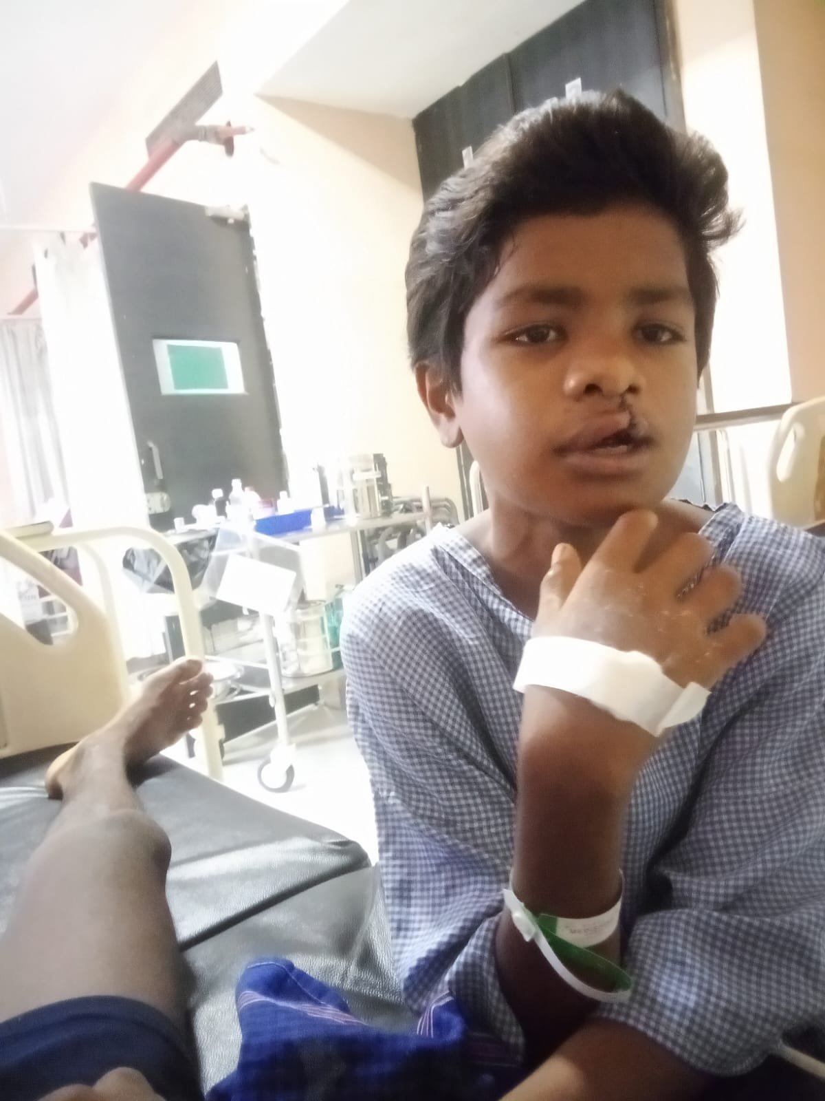 15 साल तक कटे होंठ-तालु से जूझता रहा बच्चा: ‘चिरायु’ दल ने कराया मुफ्त ऑपरेशन, चेहरे पर लौटी मुस्कान