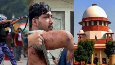 पैलेट गन के इस्तेमाल पर अभी रोक नहीं, SC ने कहा- घायल लोगों का सही इलाज कराया जाए