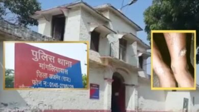 ‘तू डायन है…’ आरोप लगाकर पहले पीटा, फिर लड़की को रॉड से दागा; अजमेर में हैवानियत की हद पार