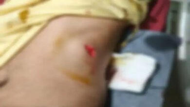 रायपुर में दो जगह चाकूबाजी, ई-रिक्शा चालक समेत तीन घायल; हत्या के प्रयास का केस दर्ज