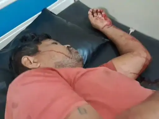 जमीन और रास्ते के विवाद में भिड़े दो परिवार, 14 लोगों पर केस: टांगी, रॉड और डंडों से हमले में 4 घायल जमीन और रास्ते के विवाद में भिड़े दो परिवार, 14 लोगों पर केस: टांगी, रॉड और डंडों से हमले में 4 घायल
