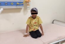 आंगनबाड़ी जांच में पहचान, एम्स रायपुर में सफल कॉक्लियर इम्प्लांट: डोंगरगढ़ की जीविका को मिली सुनने की नई उम्मीद