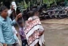 गोद में जला बच्चा… स्ट्रेचर के लिए भटकती रही मां, सयाजी हॉस्पिटल में इंसानियत शर्मसार: RMO ने दिए जांच के आदेश