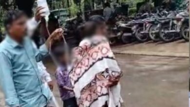 गोद में जला बच्चा… स्ट्रेचर के लिए भटकती रही मां, सयाजी हॉस्पिटल में इंसानियत शर्मसार: RMO ने दिए जांच के आदेश