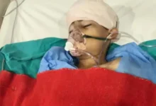BHU कैंपस में 11 वर्षीय बच्चे पर आवारा कुत्ते का हमला, सिर-चेहरे पर गंभीर चोट, लगे 50 टांके
