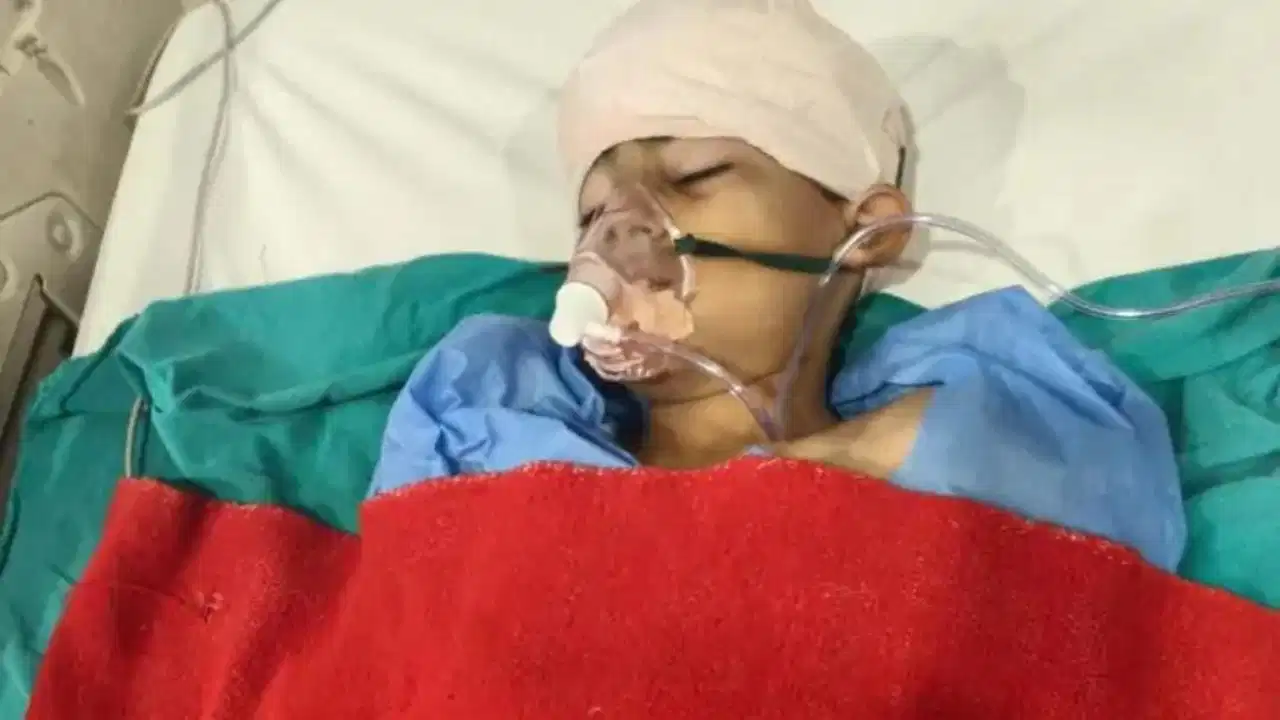 BHU कैंपस में 11 वर्षीय बच्चे पर आवारा कुत्ते का हमला, सिर-चेहरे पर गंभीर चोट, लगे 50 टांके