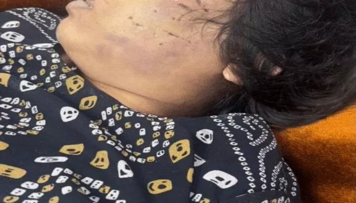रायपुर में दो हत्या मामलों का खुलासा, लिव-इन पार्टनर और प्रेमी पर हत्या के आरोप रायपुर में दो हत्या मामलों का खुलासा, लिव-इन पार्टनर और प्रेमी पर हत्या के आरोप