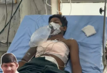 छात्र के सीने में घुसा तीर:दिल से लगातार बह रहा था खून, डॉक्टरों ने 4 घंटे तक किया ऑपरेशन