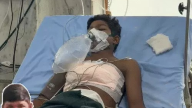 छात्र के सीने में घुसा तीर:दिल से लगातार बह रहा था खून, डॉक्टरों ने 4 घंटे तक किया ऑपरेशन