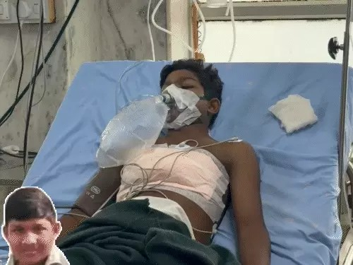 छात्र के सीने में घुसा तीर:दिल से लगातार बह रहा था खून, डॉक्टरों ने 4 घंटे तक किया ऑपरेशन छात्र के सीने में घुसा तीर:दिल से लगातार बह रहा था खून, डॉक्टरों ने 4 घंटे तक किया ऑपरेशन