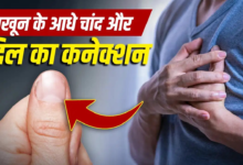 नाखून में दिखने वाले आधे चांद का हार्ट-किडनी की हेल्थ से कनेक्शन, एक्सपर्ट से जानें