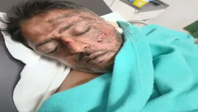 मामूली विवाद में युवक पर डंडे से हमला, सिर पर वार कर किया लहूलुहान; आरोपी के खिलाफ केस दर्ज