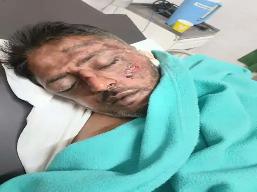 मामूली विवाद में युवक पर डंडे से हमला, सिर पर वार कर किया लहूलुहान; आरोपी के खिलाफ केस दर्ज